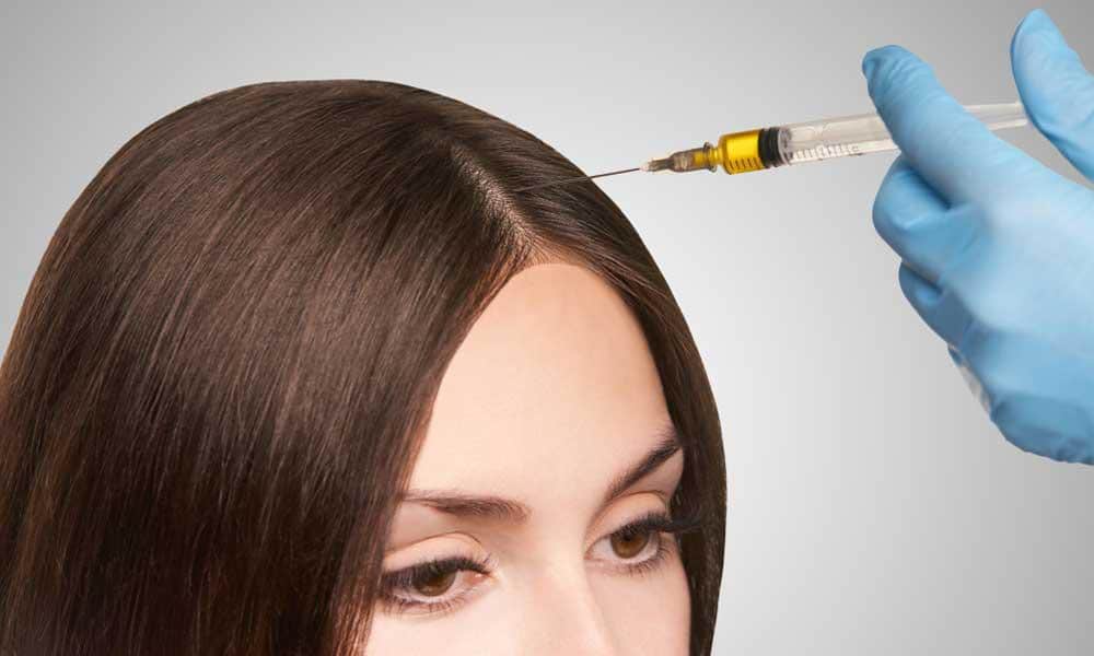 Read more about the article PRP for Hair and Skin