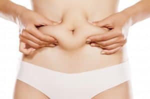 Tummy Tuck