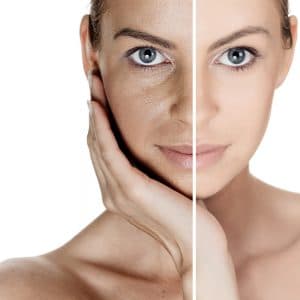 pigmentation-skin-care