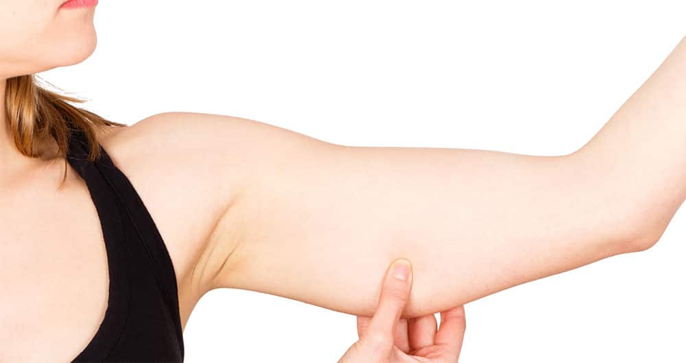 Read more about the article Upper Arm Lift