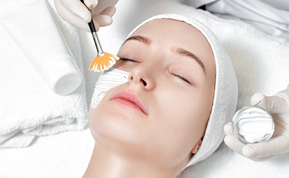 Read more about the article Chemical Peel