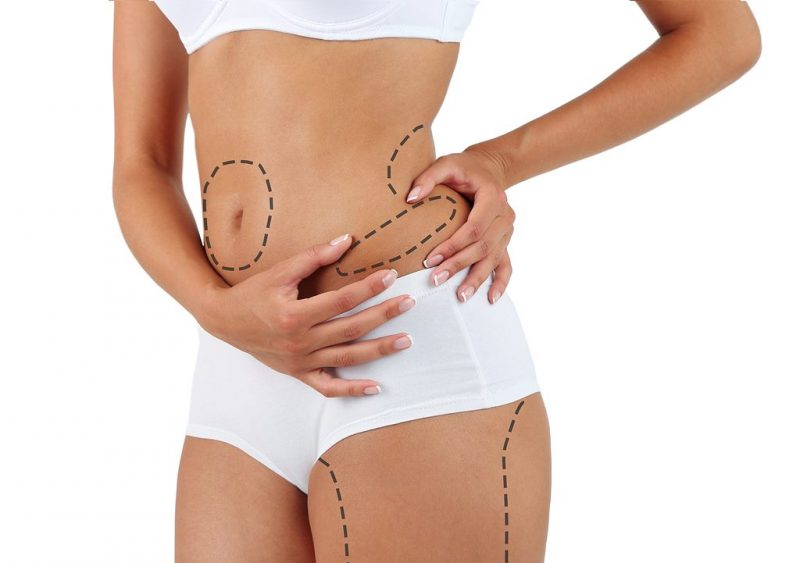Body-Sculpting With Liposuction: The Perfect Way To Attain Your Ideal Body Shape