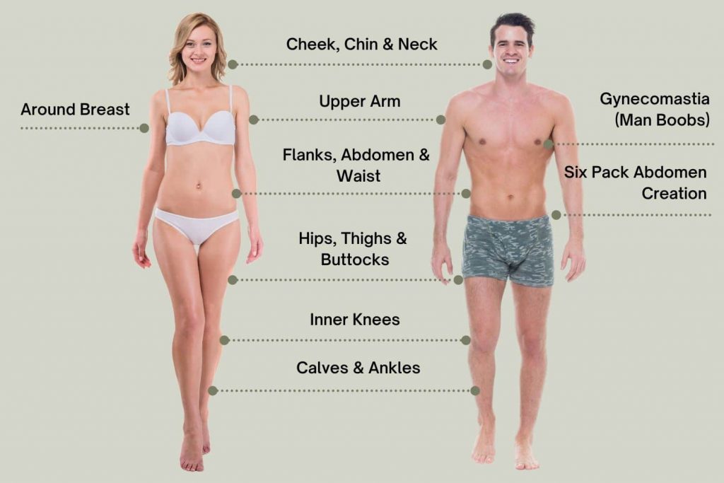 Liposuction-Areas-5.jpg