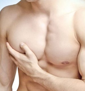 gynecomastia-vcc-men